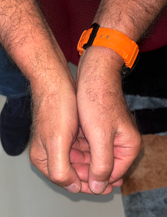 Hände mit orangefarbener Uhr im Fokus